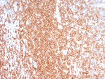 CD27 Antibody