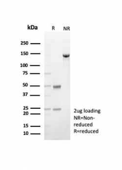 CD57 / HNK-1 Antibody