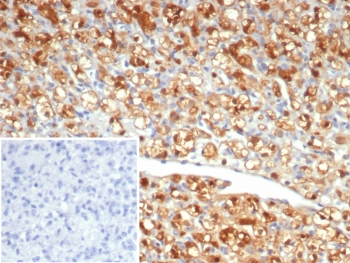 NSE Antibody / Neuron Specific Enolase