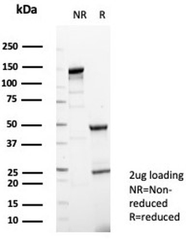 NSE Antibody / Neuron Specific Enolase