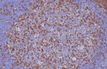 CD3 epsilon Antibody