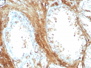 Recombinant Transgelin Antibody / SM22 alpha