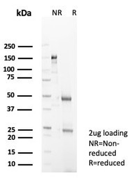 IL-18 Antibody