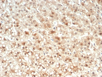 IL-18 Antibody