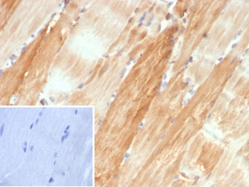 Alpha B Crystallin Antibody / CRYAB