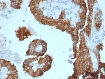 Alpha B Crystallin Antibody / CRYAB