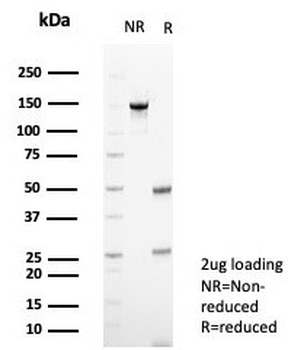 NCAM / CD56 Antibody