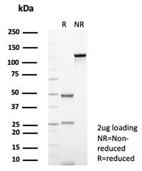 NCAM / CD56 Antibody