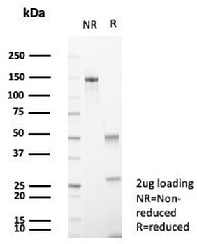 NCAM / CD56 Antibody