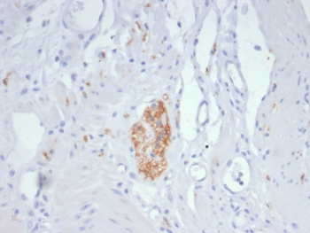 NCAM / CD56 Antibody