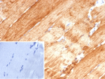 Alpha B Crystallin Antibody / CRYAB