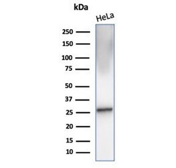 Alpha B Crystallin Antibody / CRYAB