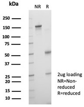 Alpha B Crystallin Antibody / CRYAB