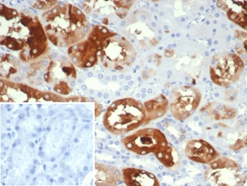 Alpha B Crystallin Antibody / CRYAB