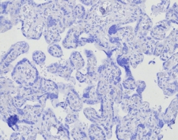 POU2AF1 Antibody / BOB-1