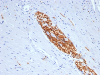 NCAM / CD56 Antibody