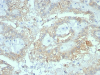 Alpha B Crystallin Antibody / CRYAB