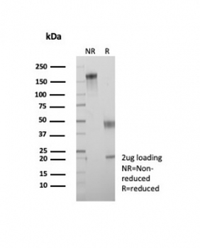 Alpha B Crystallin Antibody / CRYAB