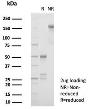 NCAM / CD56 Antibody
