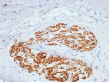 NCAM / CD56 Antibody
