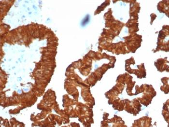 Alpha B Crystallin Antibody / CRYAB