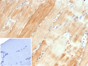 Alpha B Crystallin Antibody / CRYAB
