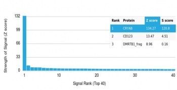 Alpha B Crystallin Antibody / CRYAB