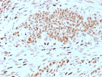 DRAP1 Antibody / NC2 alpha