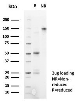 DRAP1 Antibody / NC2 alpha