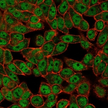 DRAP1 Antibody / NC2 alpha
