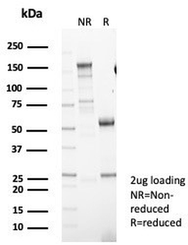DRAP1 Antibody / NC2 alpha