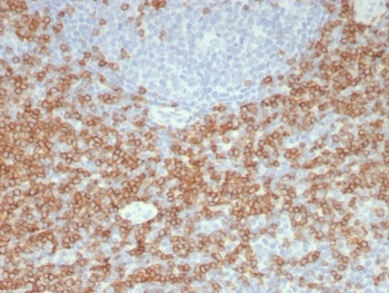 Recombinant CD5 Antibody