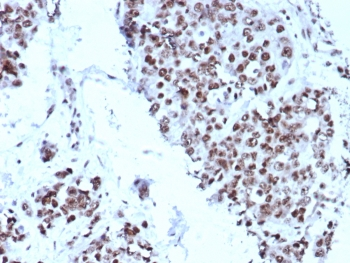 p57 Antibody / p57Kip2