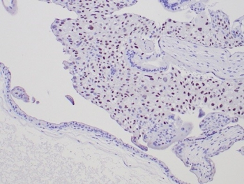 p57 Antibody / p57Kip2