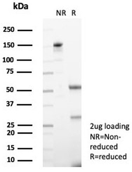 TRPC6 Antibody