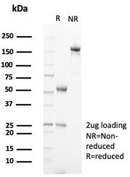 TRPC6 Antibody