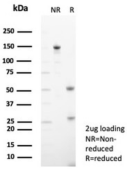 Tryptophan Hydroxylase Antibody / TPH1