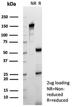 Tryptophan Hydroxylase Antibody / TPH1