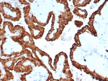 Alpha B Crystallin Antibody / CRYAB