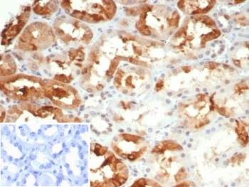 Alpha B Crystallin Antibody / CRYAB