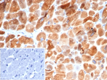 Alpha B Crystallin Antibody / CRYAB