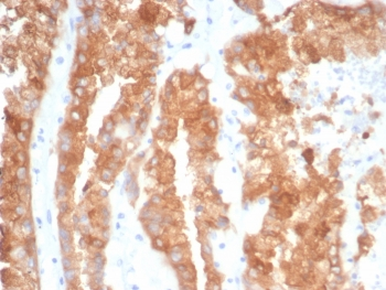 Alpha B Crystallin Antibody / CRYAB