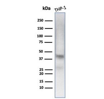 WT1 Antibody / Wilms Tumor 1