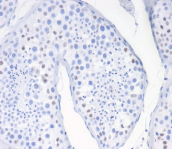 WT1 Antibody / Wilms Tumor 1