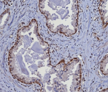 MGMT Antibody
