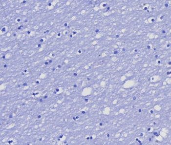 MGMT Antibody