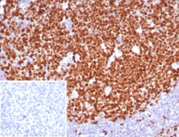 Ki-67 Antibody
