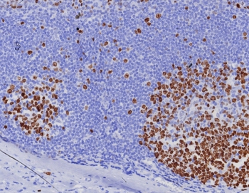 Ki-67 Antibody