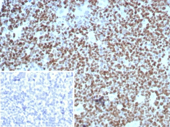 Ki-67 Antibody
