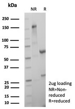 MGMT Antibody